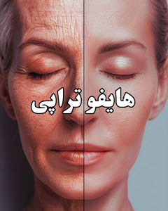 هایفو در کرج